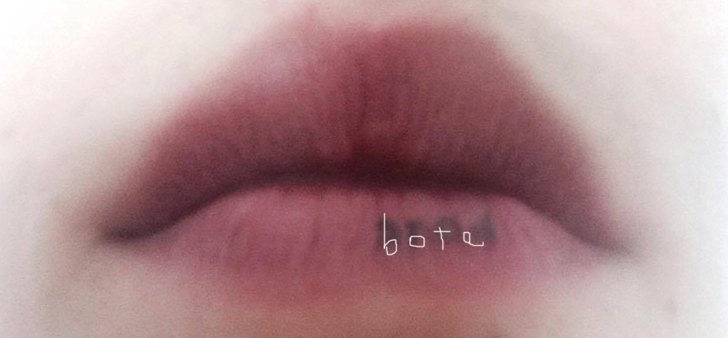 BOTE